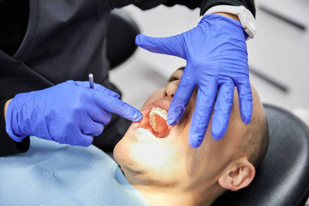 Best Chipped Tooth Repair Near Me  in North Branch, MN